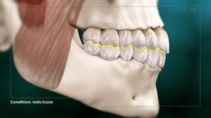 Healthy Occlusion