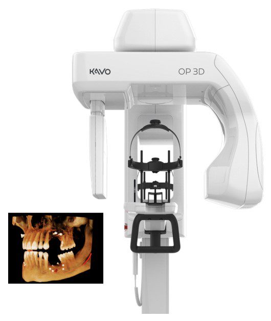 KaVo OP 3D dental imaging system